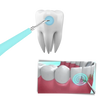 Máquina de limpieza profunda del sarro dental - Ozayti
